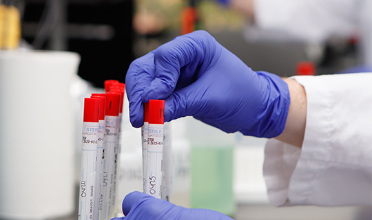 lab tech services allergens