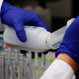 Sample Testing, Casein (ppm)