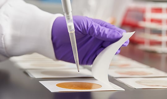 A food safety lab technician and gloves carrying out quality indicator testing using a Petrifilm Plate.