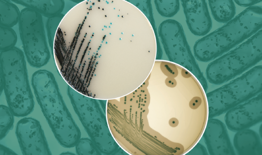 Containers of dehydrated culture media for microbial growth and food safety testing.